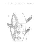 Bone Fusion Implant Device diagram and image