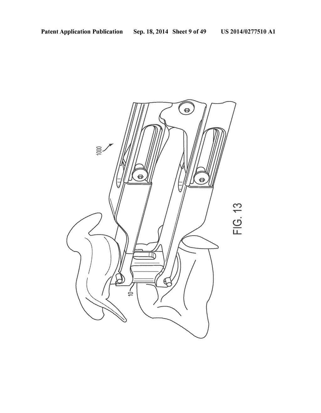 EXPANDABLE VERTEBRAL BODY REPLACEMENT DEVICE, SYSTEM, AND METHODS - diagram, schematic, and image 10