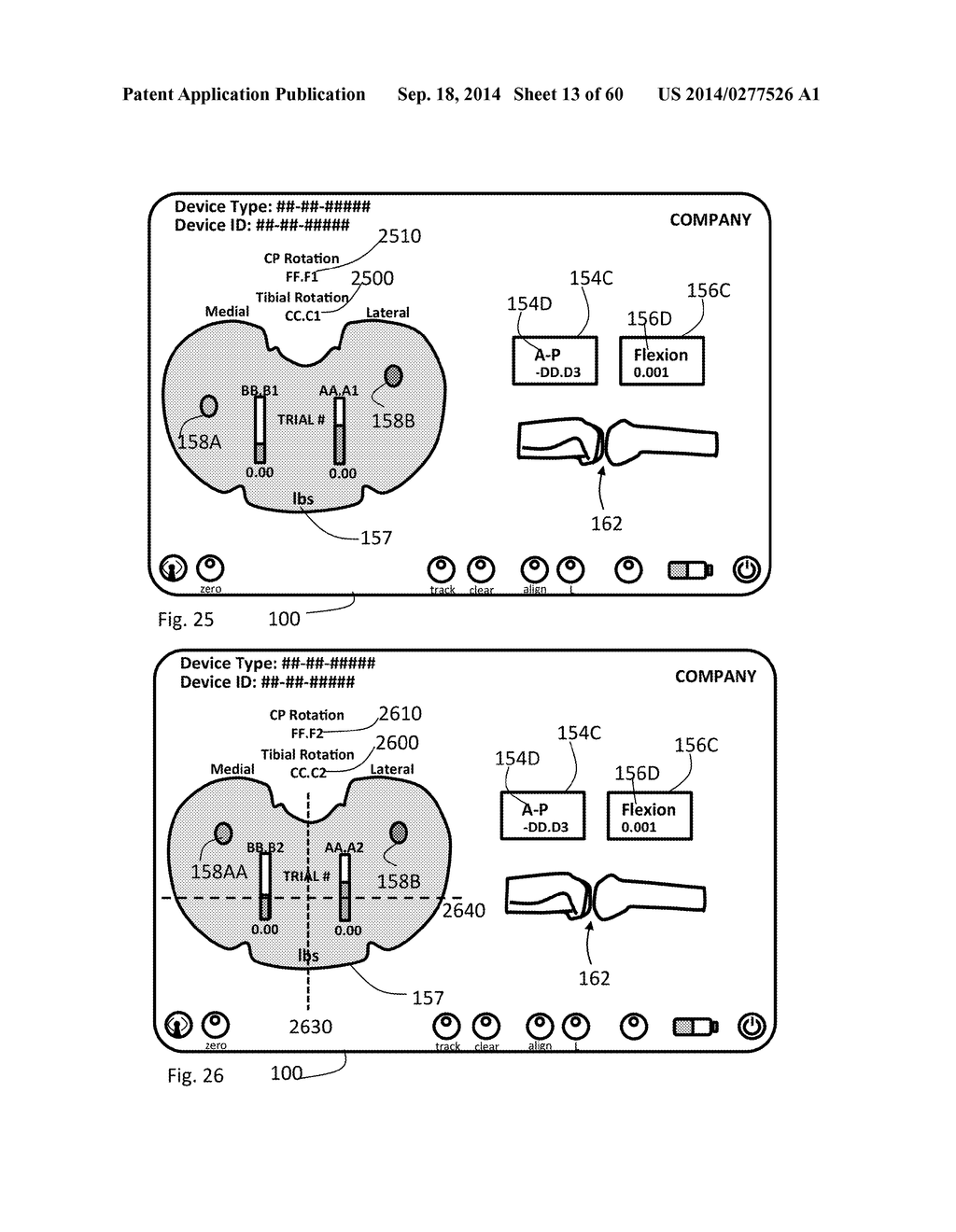 KINETIC ASSESSMENT AND ALIGNMENT OF THE MUSCULAR-SKELETAL SYSTEM AND     METHOD THEREFOR - diagram, schematic, and image 14