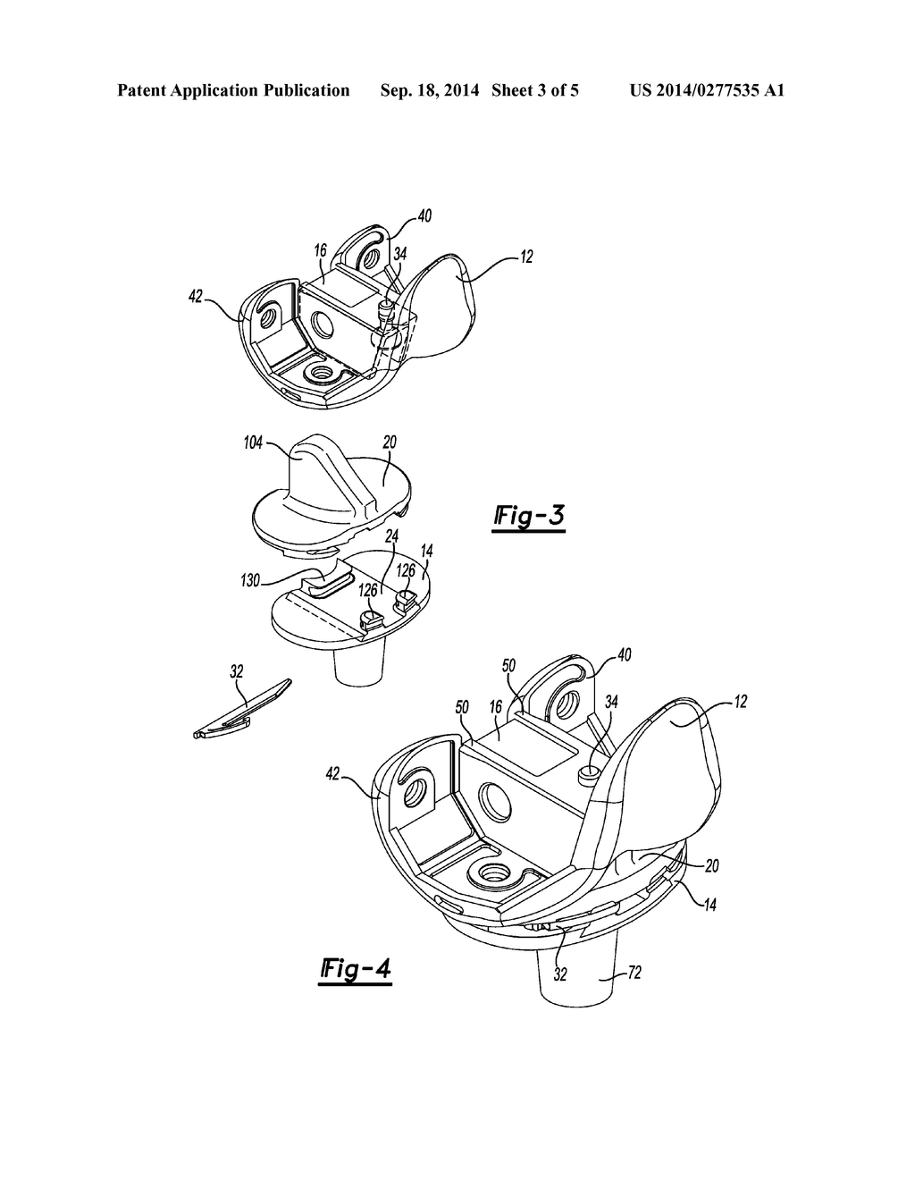 Knee Prosthesis System - diagram, schematic, and image 04