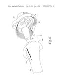 TIBIAL IMPACTION GUIDE SURGICAL INSTRUMENT AND METHOD OF USING SAME diagram and image