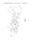 TIBIAL IMPACTION GUIDE SURGICAL INSTRUMENT AND METHOD OF USING SAME diagram and image