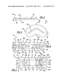 SPRING-LOADED ADJUSTABLE JOINT SPACER/BEARING TRIAL SYSTEM diagram and image