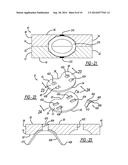 SPRING-LOADED ADJUSTABLE JOINT SPACER/BEARING TRIAL SYSTEM diagram and image