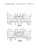 SPRING-LOADED ADJUSTABLE JOINT SPACER/BEARING TRIAL SYSTEM diagram and image