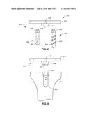 SYSTEMS AND METHODS FOR JOINT REPAIR INCLUDING SUBCHONDRAL TREATMENT OF     BONE diagram and image