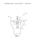 SYSTEMS AND METHODS FOR JOINT REPAIR INCLUDING SUBCHONDRAL TREATMENT OF     BONE diagram and image