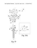 TIBIAL TRIAL INSTRUMENTS FOR SETTING OFFSET diagram and image