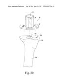 TIBIAL TRIAL INSTRUMENTS FOR SETTING OFFSET diagram and image