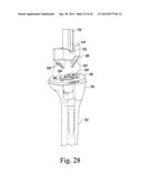 TIBIAL TRIAL INSTRUMENTS FOR SETTING OFFSET diagram and image