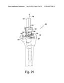 TIBIAL TRIAL INSTRUMENTS FOR SETTING OFFSET diagram and image