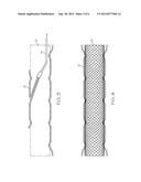 STENT HAVING REMOVABLE ANCHORING ELEMENT diagram and image