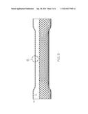 STENT HAVING REMOVABLE ANCHORING ELEMENT diagram and image