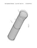 STENT HAVING REMOVABLE ANCHORING ELEMENT diagram and image