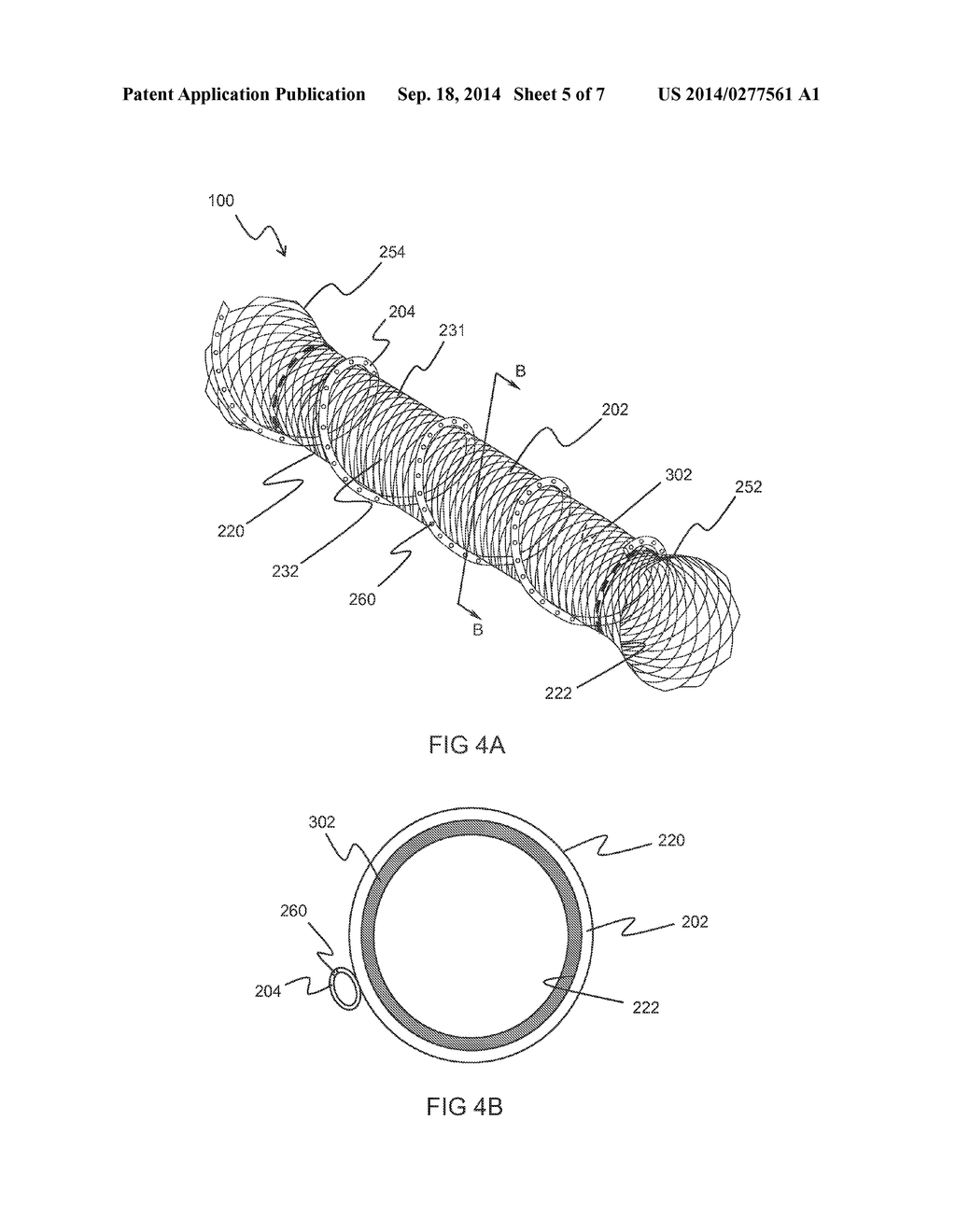 PANCREATIC STENT DRAINAGE SYSTEM - diagram, schematic, and image 06