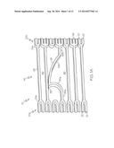 Anti-Migration Tissue Anchoring System for a Fully Covered Stent diagram and image