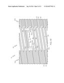 Anti-Migration Tissue Anchoring System for a Fully Covered Stent diagram and image