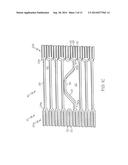 Anti-Migration Tissue Anchoring System for a Fully Covered Stent diagram and image