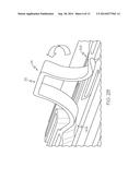 Anti-Migration Tissue Anchoring System for a Fully Covered Stent diagram and image