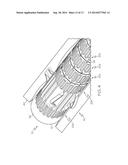 Anti-Migration Tissue Anchoring System for a Fully Covered Stent diagram and image