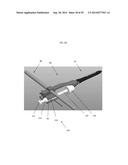 VOID FILLING JOINT PROSTHESIS AND ASSOCIATED INSTRUMENTS diagram and image