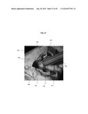 VOID FILLING JOINT PROSTHESIS AND ASSOCIATED INSTRUMENTS diagram and image