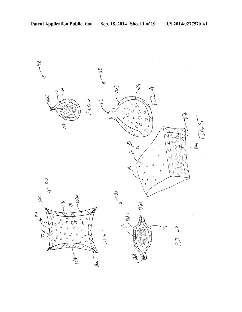 BONE GROWTH PROMOTION SYSTEMS AND METHODS - diagram, schematic, and image 02