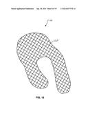 BONE GROWTH PROMOTION SYSTEMS AND METHODS diagram and image