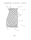 ESOPHAGEAL STENT diagram and image