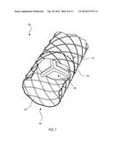 ESOPHAGEAL STENT diagram and image