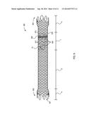 ESOPHAGEAL STENT diagram and image