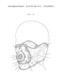 Cold Weather Exposure Mask diagram and image