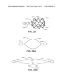 METHODS AND DEVICES FOR CRIMPING SELF-EXPANDING DEVICES diagram and image