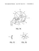 ERGONOMICALLY FORMED HEADGEAR STRAPS diagram and image