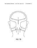 ERGONOMICALLY FORMED HEADGEAR STRAPS diagram and image