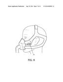 ERGONOMICALLY FORMED HEADGEAR STRAPS diagram and image