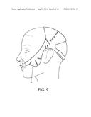 ERGONOMICALLY FORMED HEADGEAR STRAPS diagram and image