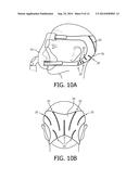 ERGONOMICALLY FORMED HEADGEAR STRAPS diagram and image