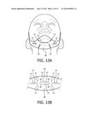 ERGONOMICALLY FORMED HEADGEAR STRAPS diagram and image