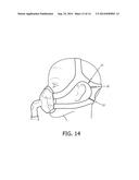 ERGONOMICALLY FORMED HEADGEAR STRAPS diagram and image