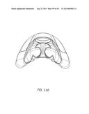 INTERFACE COMPRISING A NASAL SEALING PORTION diagram and image