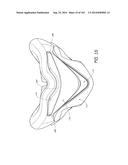 INTERFACE COMPRISING A NASAL SEALING PORTION diagram and image