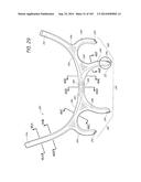 INTERFACE COMPRISING A NASAL SEALING PORTION diagram and image