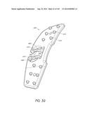 INTERFACE COMPRISING A NASAL SEALING PORTION diagram and image