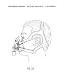 INTERFACE COMPRISING A NASAL SEALING PORTION diagram and image