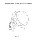 INTERFACE COMPRISING A NASAL SEALING PORTION diagram and image