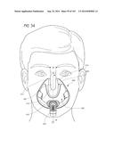 INTERFACE COMPRISING A NASAL SEALING PORTION diagram and image