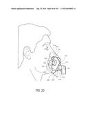 INTERFACE COMPRISING A NASAL SEALING PORTION diagram and image