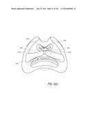 INTERFACE COMPRISING A NASAL SEALING PORTION diagram and image