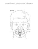 INTERFACE COMPRISING A NASAL SEALING PORTION diagram and image